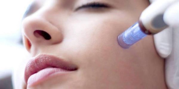Meso-Needling